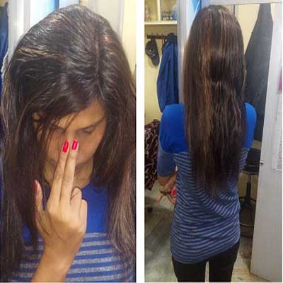 Ladies-Hair-Patch Ladies-Hair-Patch